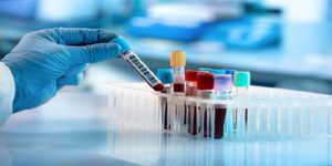 Analisi e Misura dell’Impedenza del sangue